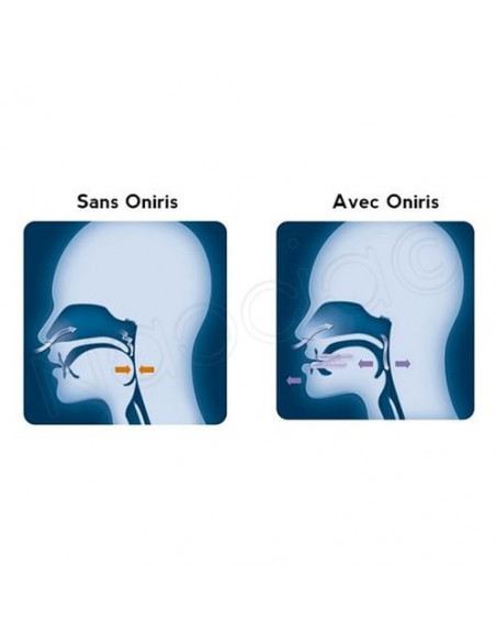 Oniris Orthèse Anti-Ronflement  - 5