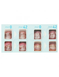 Excilor Traitement Mycose de l'Ongle Stylet 400 applications - JeCare 2