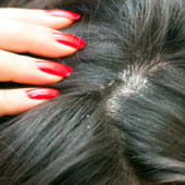 pellicules cheveux parapharmacie