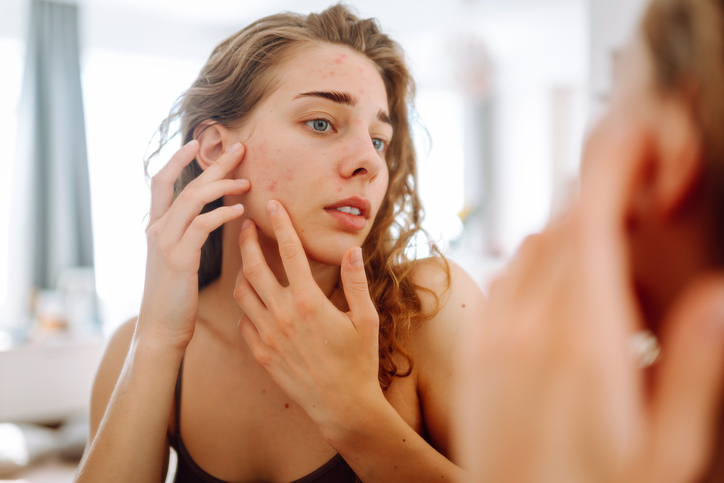 Jeune femme observant dans le miroir les imperfections de sa joue